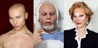 Real English Conversation: Plastic Surgery Plastic Surgery